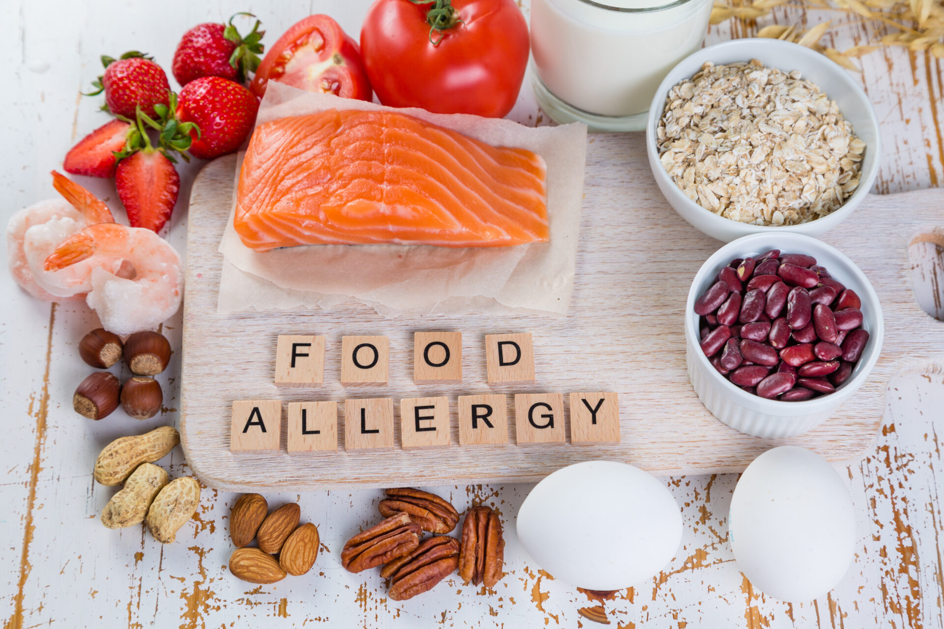 What Are The 10 Most Common Allergies Food